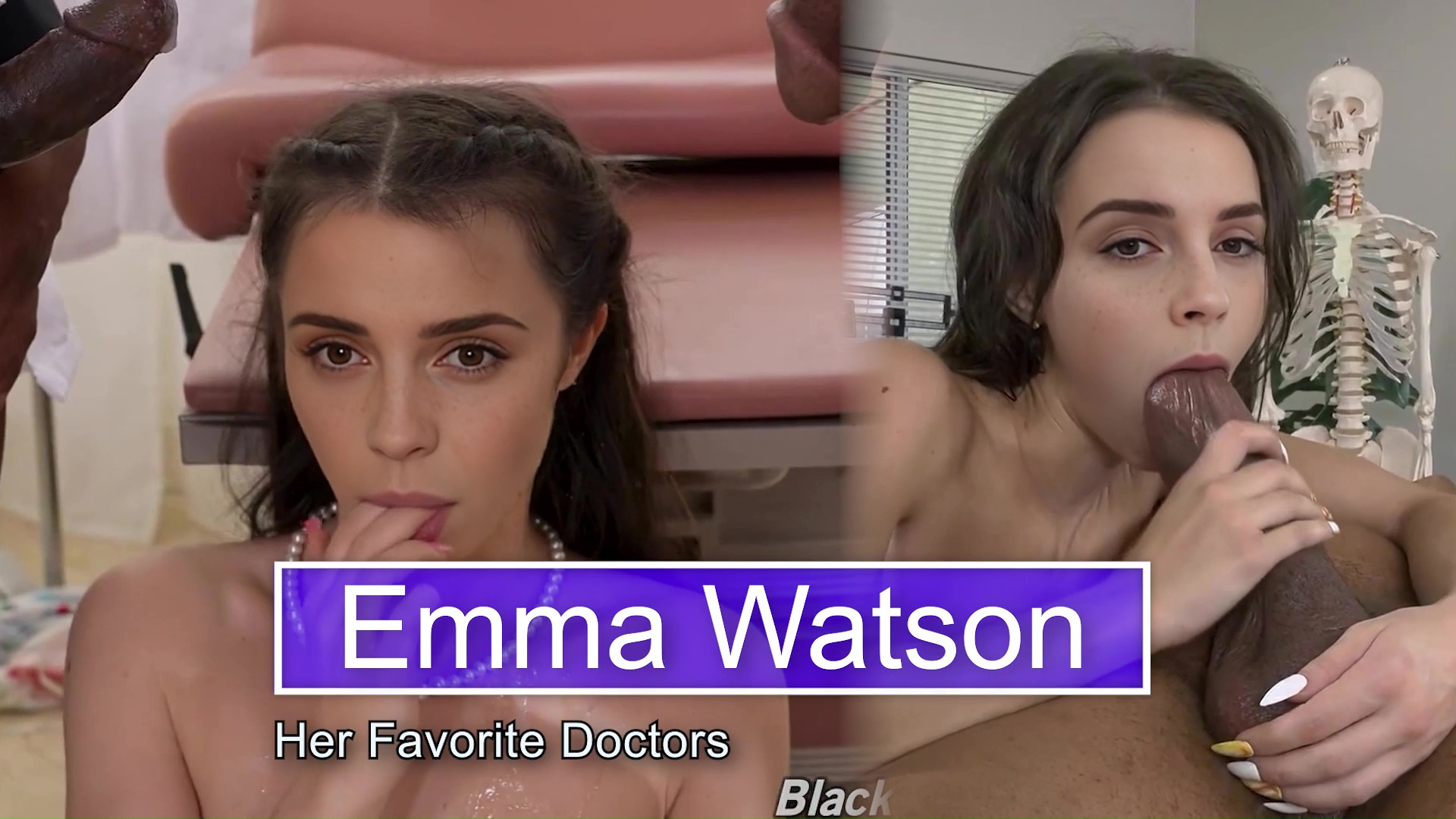 Emma Watson - Her Favorite Doctors - Trailer